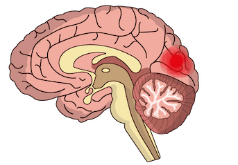 Image of brain